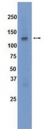 AM32481SU-N - Tyrosine-protein kinase JAK3