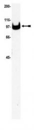 AM32528PU-N - ATP1A3