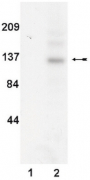 AM32529PU-N - Tyrosine-protein kinase JAK3