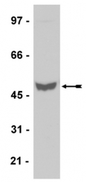 AM32557PU-N - Fibrinogen gamma chain