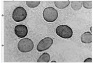 AM32571SU-N - Hexokinase-3