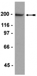 AM32638SU-N - Neurofilament H (200 kD)