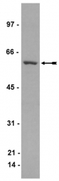 AM32694SU-N - CRMP1 / DPYSL1