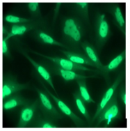 AM32709PU-N - MYOD1