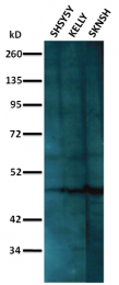 AM32710PU-N - NEUROD1