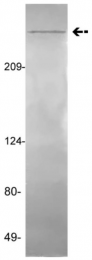 AM32720PU-N - von Willebrand factor (VWF)