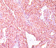 AM32789SU-S - Chromogranin A