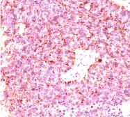 AM32789SU-S - Chromogranin A