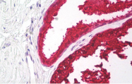 AM32794PU-N - Kallikrein-3 / PSA / KLK3