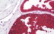AM32795PU-N - Kallikrein-3 / PSA / KLK3