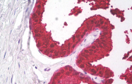 AM32796PU-N - Kallikrein-3 / PSA / KLK3