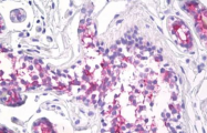 AM32800PU-N - CD227 / Mucin-1 / MUC1