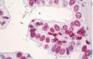 AM32802PU-N - Histone H3F3B