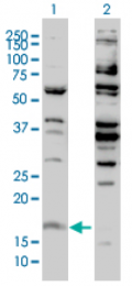 AM32802PU-N - Histone H3F3B