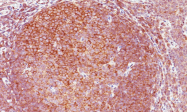 AM32814PU-T - Bcl-10