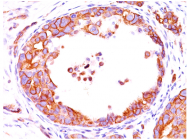 AM32822PU-T - CD340 / ERBB2 / HER2