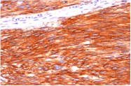 AM32824PU-S - CD117 / c-kit