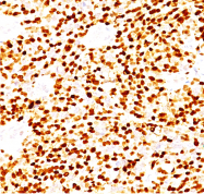 AM32825PU-T - Myogenin