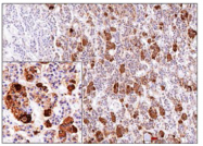 AM32828PU-T - Adrenocorticotropic Hormone (ACTH)