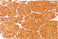 AM32831PU-S - Tyrosinase (TYR)