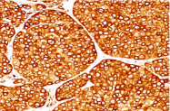 AM32831PU-S - Tyrosinase (TYR)