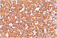AM32837PU-S - Vimentin