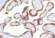 AM32839PU-T - Chorionic Gonadotropin (hCG)