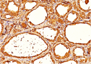 AM32841PU-T - Thyroglobulin