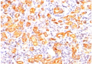 AM32842PU-T - CD227 / Mucin-1 / MUC1