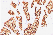 AM32844PU-N - Estrogen receptor alpha