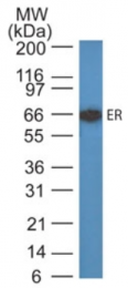 AM32844PU-N - Estrogen receptor alpha