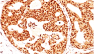 AM32846PU-T - Estrogen receptor beta
