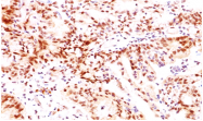 AM32846PU-T - Estrogen receptor beta