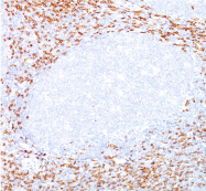 AM32847SU-S - CD8