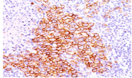 AM32849PU-T - CD30