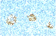 AM32850PU-T - NKX2-2