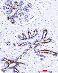 AM32855PU-T - Progesterone receptor