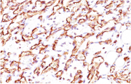 AM32857PU-T - Podocalyxin / PODXL