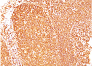 AM32859PU-S - CD45 / LCA