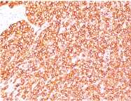 AM32859PU-S - CD45 / LCA
