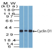 AM32864PU-T - Cyclin D1