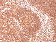 AM32866PU-S - CD45 / LCA