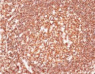 AM32866PU-S - CD45 / LCA