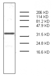 AM32963PU-N - S100A7 / Psoriasin
