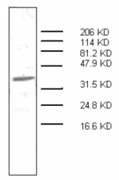 AM32964PU-N - S100A7 / Psoriasin