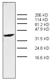 AM32966PU-N - S100A7 / Psoriasin