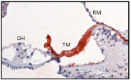 AM32984PU-N - CEACAM16