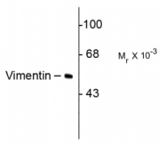 AM32993PU-N - Vimentin