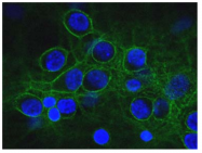 AM32996PU-N - Spectrin alpha chain (brain) / SPTAN1