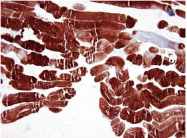 AM33000PU-N - alpha skeletal muscle Actin / ACTA1